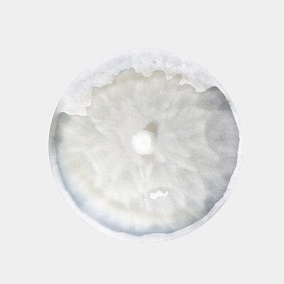 Damping-off Pythium aphanidermatum in petri dish
